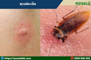 dấu vết gián cắn