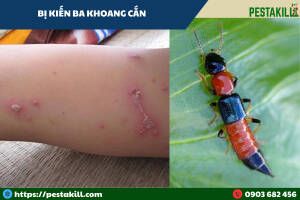 dấu vết kiến ba khoang cắn