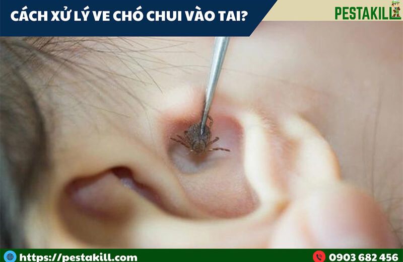 cách xử lý khi bị ve chó chui vào tai