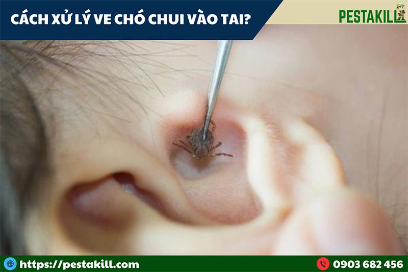 cách xử lý khi bị ve chó chui vào tai